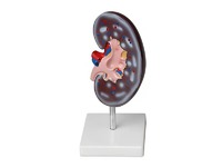 Модель почки в разрезе - fgospostavki.ru - Киров