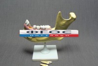 Модель "Челюсть разборная" - fgospostavki.ru - Киров