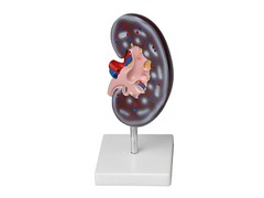 Модель почки в разрезе - fgospostavki.ru - Киров