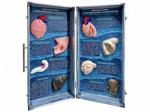 Учебно-демонстрационный кейс "Последствия употребления алкоголя и наркотиков" - fgospostavki.ru - Киров