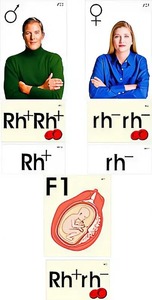 Модель-аппликация "Наследование резус-фактора" (ламинированная) - fgospostavki.ru - Киров