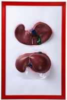Барельефная модель "Печень" - fgospostavki.ru - Киров