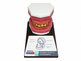 Демонстрационная модель "Ротовая полость курильщика" - fgospostavki.ru - Киров
